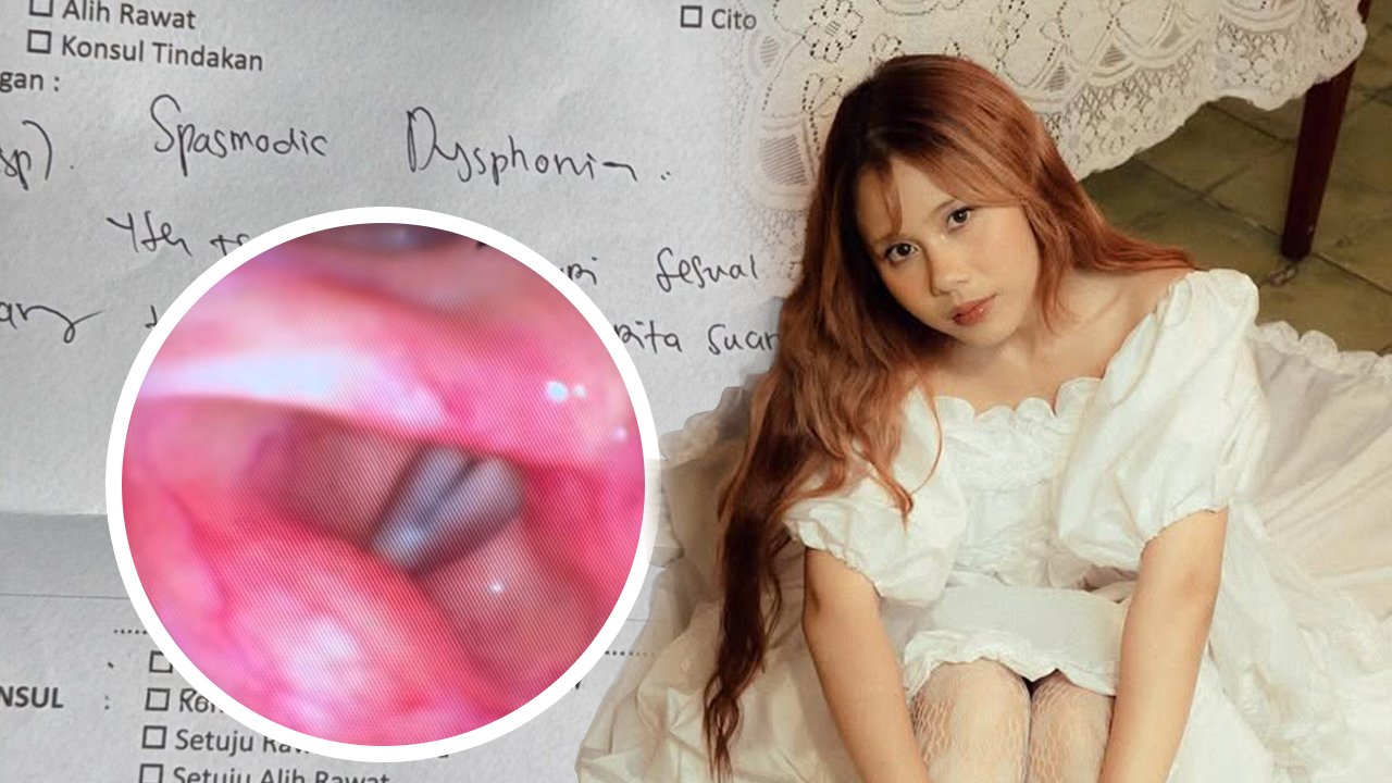 nadin amizah suara fals Spasmodic Dysphonia